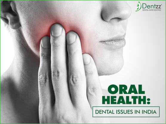 5 Oral Health Dental Issues in India