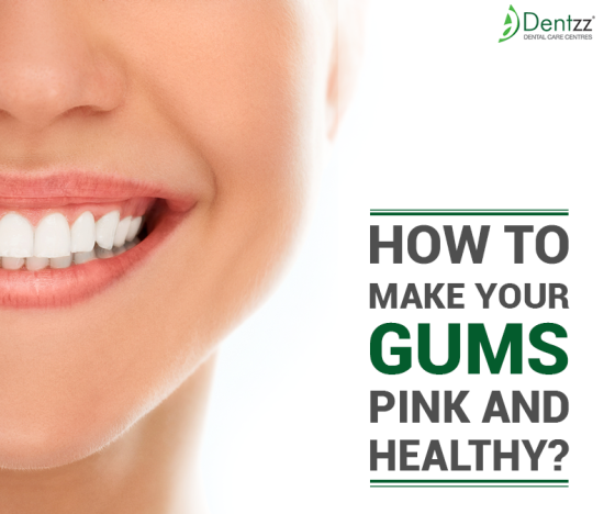 Dentzz- How to Make Your Gums Pink.png